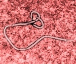 "Miracle" baby survives Ebola in Congo and rapid a new Ebola detection device