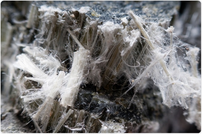 Asbestos chrysotile fibers that cause lung disease, COPD, lung cancer, mesothelioma. Image Credit: farbled / Shutterstock