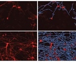 Real-Time, Long-Term Quantitative Analysis of iPSC-Derived Neuronal Cell Health