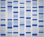 Medical diagnoses, DNA sequencing can be made faster through gel electrophoresis