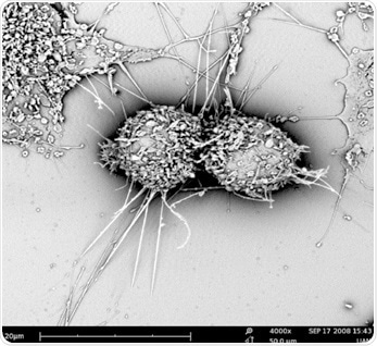 An example of mammalian cells observed with SEM.