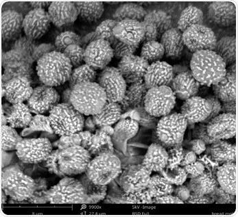 SEM image of Rhizopus stolonifer collected from bread.