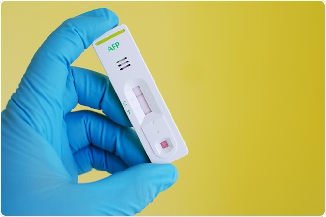 What is the Alpha Fetoprotein Test?