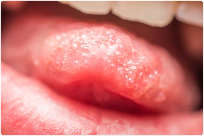 Close Up Photo Of Healthy Human Tongue Taste Buds Macro. Image Credit: Radu Bercan / Shutterstock