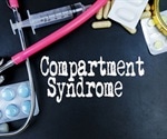 Compartment Syndrome Treatment