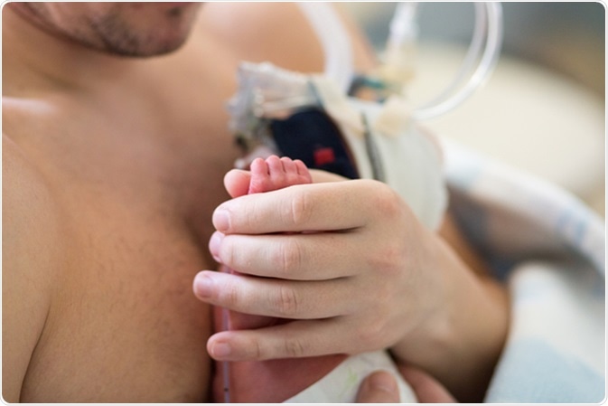 father holding a premature baby with an oxygen mask in Kangaroo method. Image Credit: Kristina Bessolova / Shutterstock