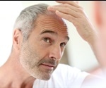 Genes that control the immune system may play role in hair graying