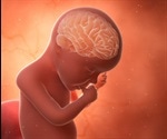 Diet may affect brain development in premature babies