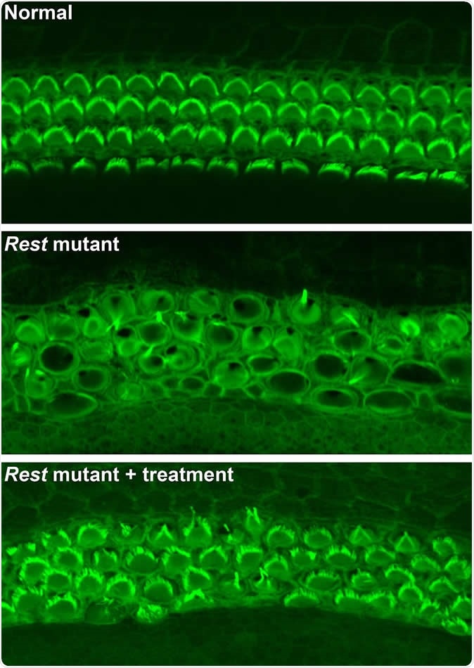 Top: Rows of healthy sensory hair cells in the mouse inner ear with green stereocilia arcs. Middle: In Rest mutant mice, hair cells are disorganized, and stereocilia barely visible. Bottom: In Rest mutant mice treated with HDAC inhibitors, organization and structure of hair cells is partially restored.Yoko Nakano, Carver College of Medicine, University of Iowa, Originally published in Cell
