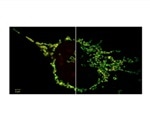 New 2D Superresolution mode for ZEISS Airyscan offers higher resolution in live cell imaging