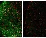 Scientists identify immune cells that remove degenerating neurons after brain injury