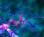 Researchers develop potential treatment for Parkinson’s disease