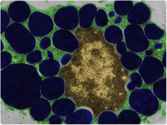 False colour transmission electron microscope (TEM) micrograph of a mast cell (mastocyte) with the cytoplasm (green) full of heparin granules (dark blue).