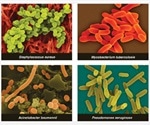 Can Phytochemicals be used against Resistant Bacterial Strains?