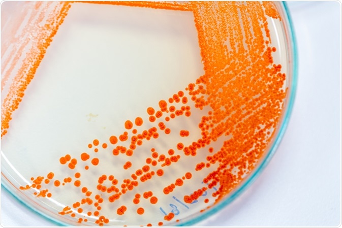 Serratia marcescens is a species of rod-shaped gram-negative bacteria in the family Enterobacteriaceae for Laboratory microbiology. Image Credit: Rattiya Thongdumhyu / Shutterstock