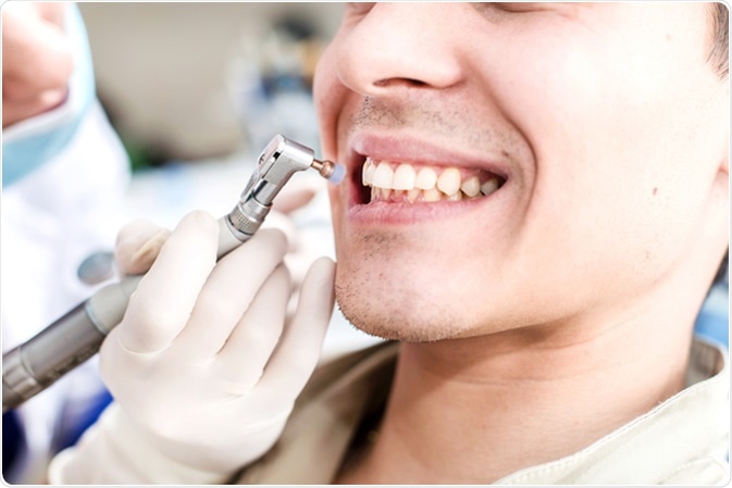 Polishing teeth close up view. Image Credit: Maksym Poriechkin / Shutterstock