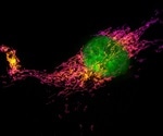 Super-resolution microscopy highlights bacterial biofilms