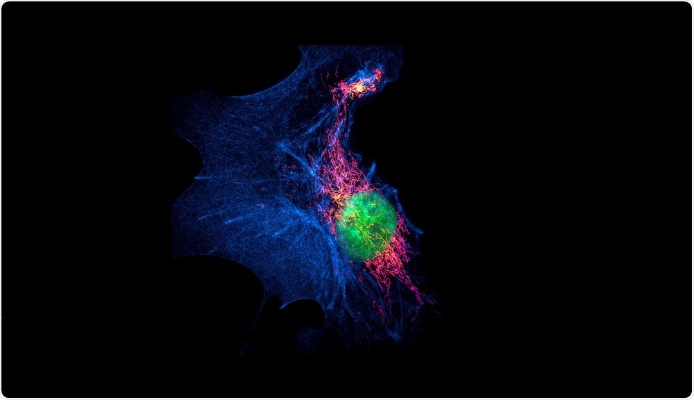 Structured illumination microscopy (SIM) images of a bovine pulmonary artery endothelial cell stained with fluorescent dyes for mitochondria, actin, nucleus.