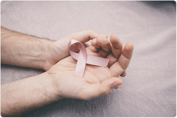 Symptoms of male breast cancer