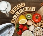 Increase in students with food allergies
