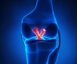 Study finds that majority of athletes return to play after having knee surgery for ACL injury