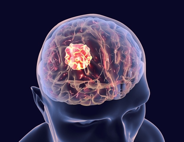 Salk scientists find new immunotherapy treatment for glioblastoma
