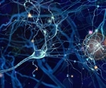 Researchers report on the role of brain cell membranes' lipids in Alzheimer's progression