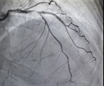 CORDIS reports positive results from 10-year follow-up of CYPHER Sirolimus-eluting coronary stent study
