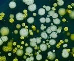 New technique detects bacterium that causes Legionnaires’ disease
