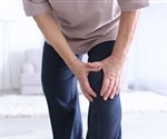 Study finds an increase in the proportion of adults in England diagnosed with inflammatory arthritis