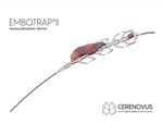 CERENOVUS announces launch of novel stent retriever for treating stroke patients