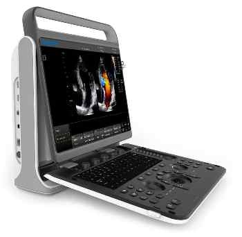 Sonologic's EBit60 Ultrasound Machine
