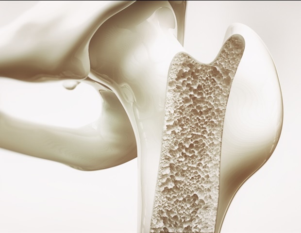 Medical doctors use octacalcium phosphate to improve bone repair