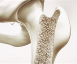 Magnesium intake positively associated with bone density