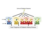 Okayama University research could improve prognosis of diabetic kidney disease