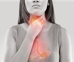 Magnetic device studied as treatment for heartburn and acid reflux