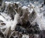 New statement published on nonmalignant diseases related to asbestos exposure