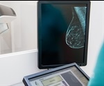 A Multi-Modal Approach for the Early Detection of Breast Cancer