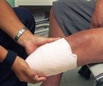 Combination of gout and diabetes carries increased risk of amputation