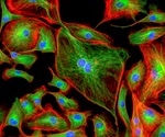 P53 and Cancer-Associated Fibroblasts
