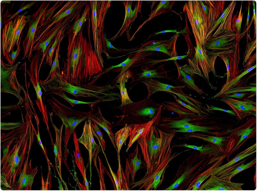 Human fibroblasts under fluorescent microscope. DNA (blue), nucleous (green), and actin (yellow/red).
