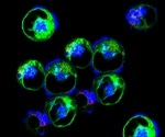 How to Analyze Cellular Necroptosis