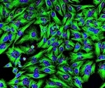 Researchers characterize production process for standardized monoclonal antibody