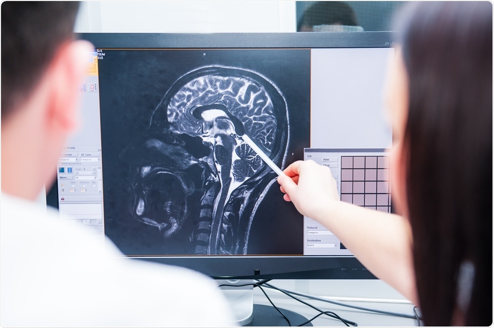 Doctors studying MRI of brain injury