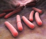 E. coli strain in poultry shown to cause bladder infections