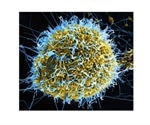 Study provides new insights into how the human immune system protects against Ebola infections