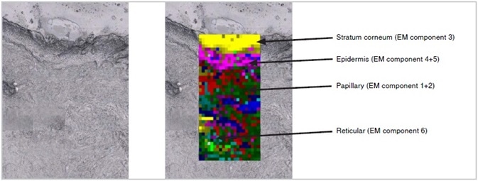 Tiled image of the unstained tissue section (left) and corresponding Empty modeling ™ processed Raman image (right) overlaid on the unstained tissue section clearly showing the different tissue layers in the skin