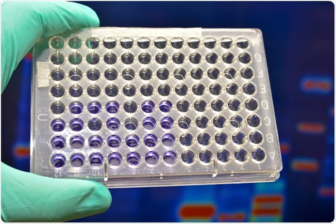 DNA testing in the laboratory. Well plates in the background electropherograms of nucleic acids. Image Credit: Sergei Drozd / Shutterstock
