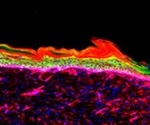 Researchers program open wound cells to turn into healthy skin