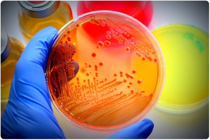 E. coli grew in (differential medium) MacConkey agar. Image Credit: CA-SSIS / Shutterstock